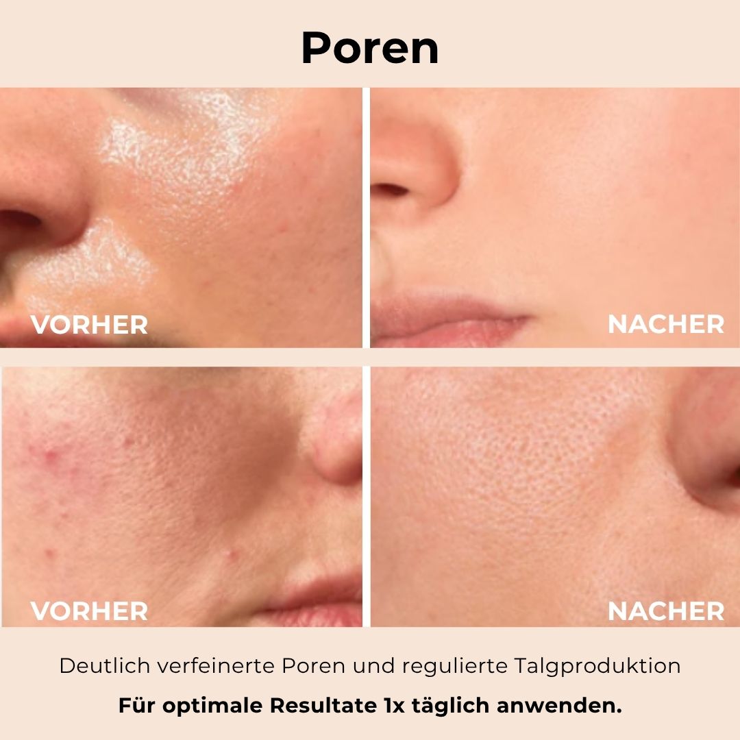 nooka GlowVeil - Nr. 1 Serum gegen Hautunreinheiten