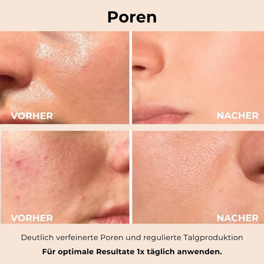 nooka GlowVeil - Nr. 1 Serum gegen Hautunreinheiten