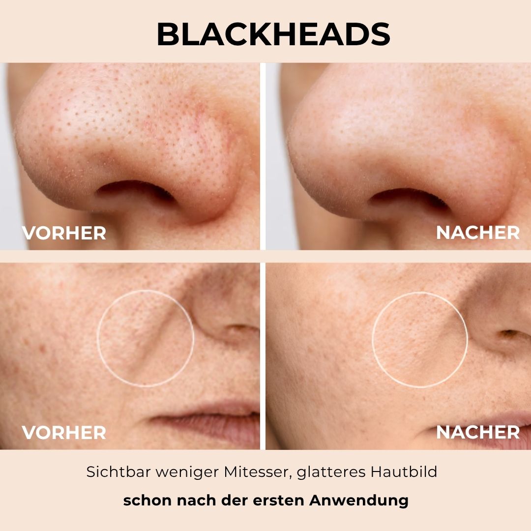 nooka GlowVeil - Nr. 1 Serum gegen Hautunreinheiten