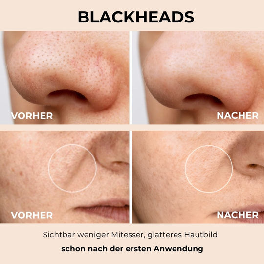 nooka GlowVeil - Nr. 1 Serum gegen Hautunreinheiten