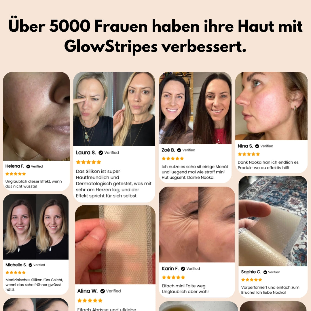 GlowStripes™ für straffe, glatte und schöne Haut!