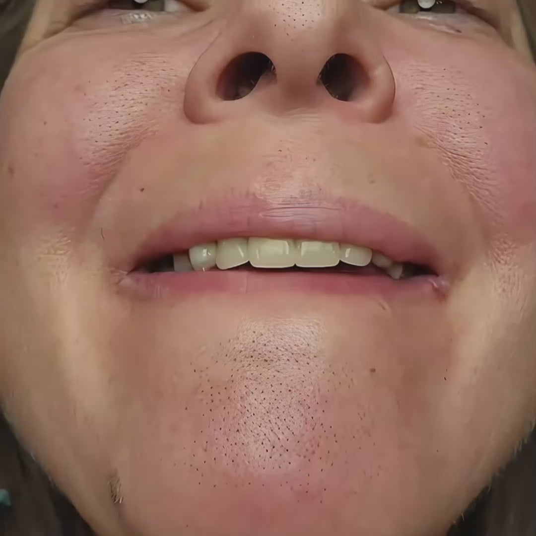 nooka GlowVeil - Nr. 1 Serum gegen Hautunreinheiten