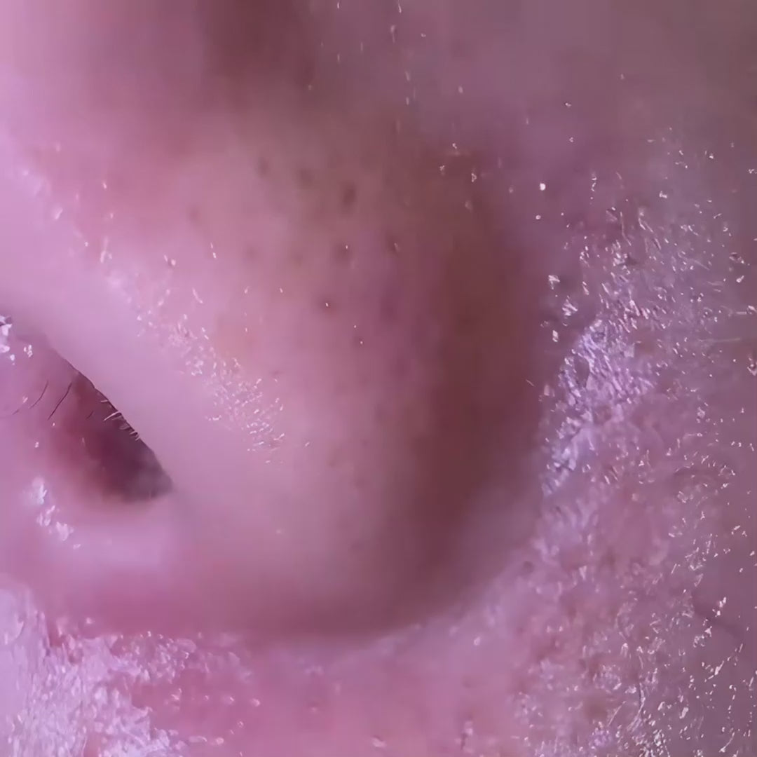 nooka GlowVeil - Nr. 1 Serum gegen Hautunreinheiten